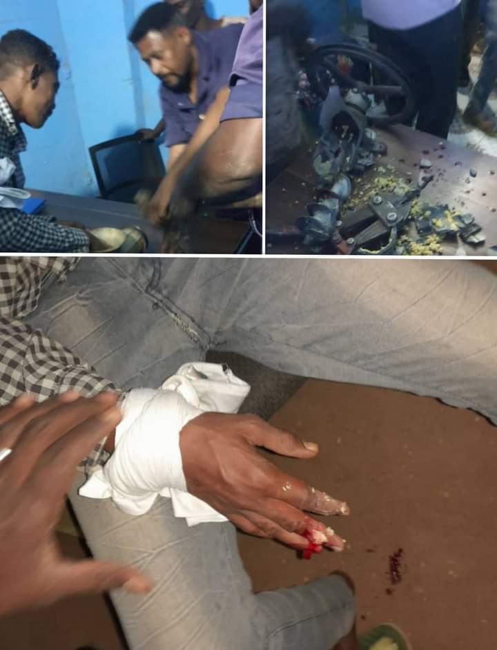 الدفاع المدني ينقذ أحد المواطنين علقت يده في( مفرمة )