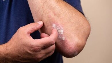 أعراض جفاف الجلد وتأثيره على صحة البشرة