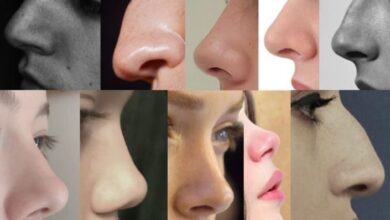 تجميل الأنف وتناسق الوجه: هل تبحث عن "الأنف المثالي"؟