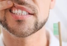 صحة اللثة وأمراض الفم