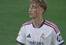 ريال مدريد يترقب حالة هويسن بعد إصابته أمام إسبانيول