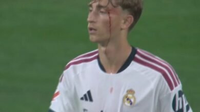 ريال مدريد يترقب حالة هويسن بعد إصابته أمام إسبانيول